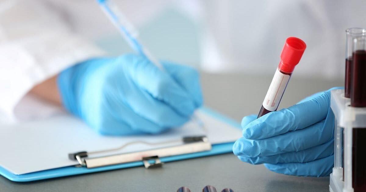 Researchers: Too Soon To Tell If ‘Liquid Biopsies’ Help More Than Harm In Cancer Screening | Health